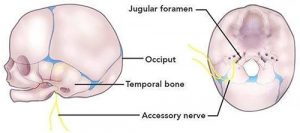 Torticollis_Osteopathic_Healing_Hands